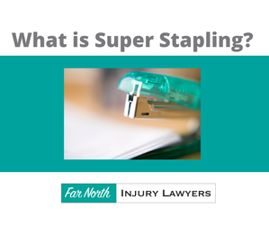 Super Stapling – what is it?